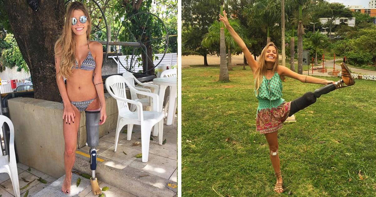 Το ακρωτηριασμένο μοντέλο που έχει γίνει σύμβολο δύναμης και θέλησης