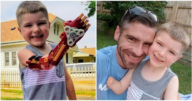 Χίλια Μπράβο σε αυτόν τον Μπαμπά! Κατασκευάζει Δωρεάν, Μηχανικά Χέρια για Παιδιά που έχουν Ανάγκη