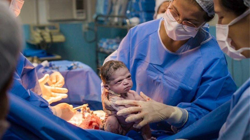 Viral φωτογραφία: Νεογέννητο κοιτά με νεύρα τον μαιευτήρα