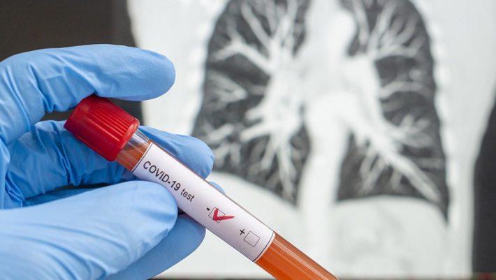 Ραγδαίες εξελίξεις στο φάρμακο για τον covid-19: Ίσως είμαστε μπροστά σε μια ιστορική στιγμή