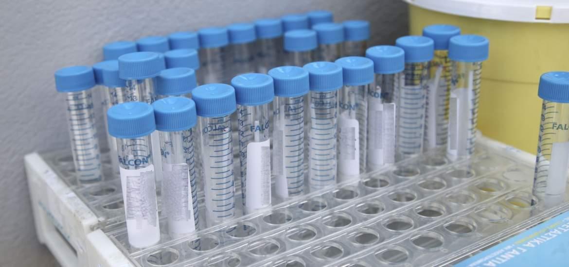 Κυκλοφορούσαν… παντού για 15 μέρες ενώ είχαν κορονοϊό! «Να μπει σε καραντίνα η περιοχή»