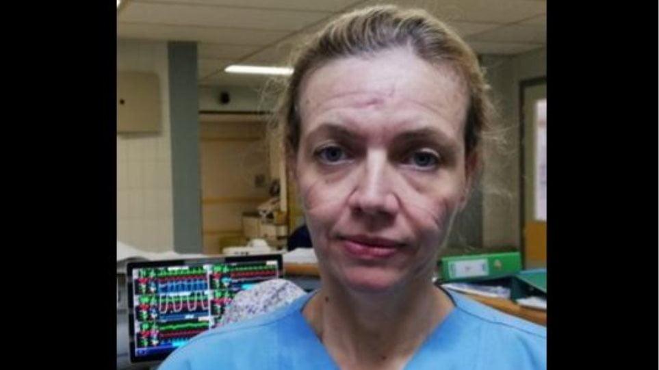 Κορωνοϊός: Συγκινητικό μήνυμα της γιατρού Ελένης Ισχάκη με τα σημάδια της μάσκας στο πρόσωπο: «Βάλ’ την λίγες ώρες, γίνε ο ήρωάς μας»