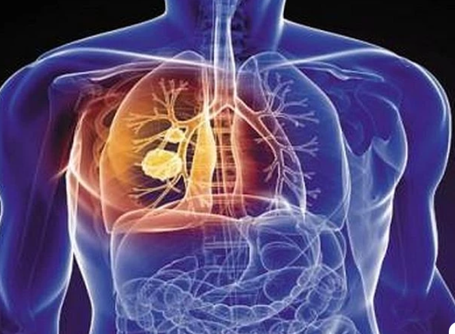 Οι επιστήμονες κρούουν τον κώδωνα του κινδύνου – Μισό εκατομμύριο Έλληνες πάσχουν από ΧΑΠ και δεν το ξέρουν