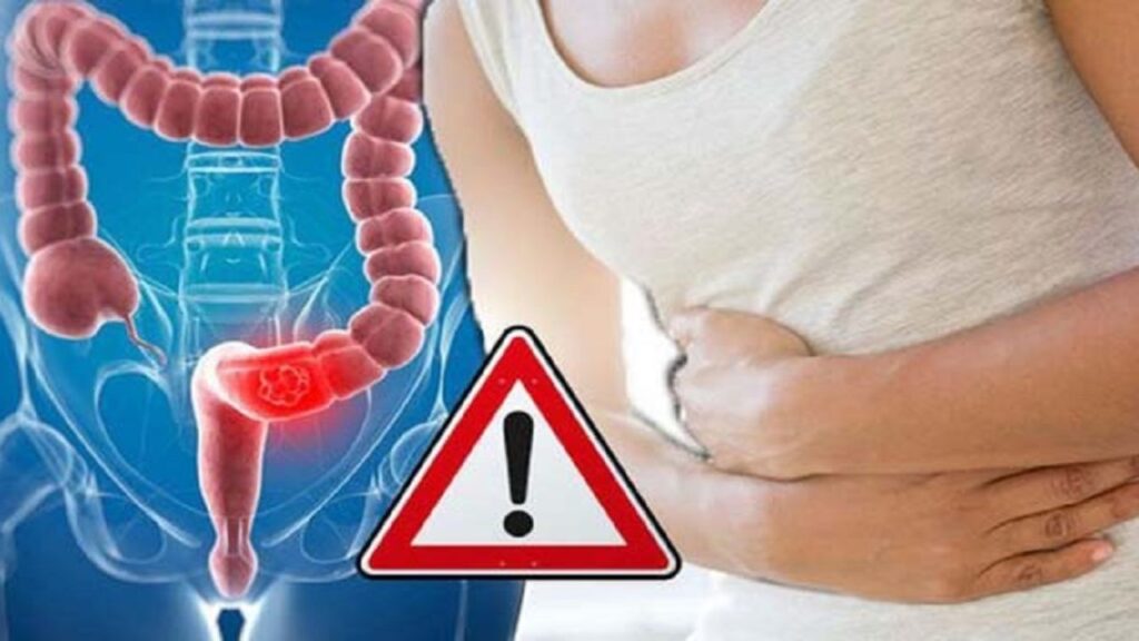 Καρκίνος παχέος εντέρου: 7 παράγοντες που πολλαπλασιάζουν τον κίνδυνο