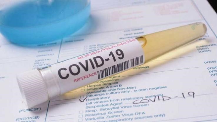 covid19