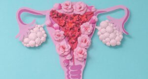 PCOS: Γιατί αλλάζει όνομα η γνωστή πάθηση των ωοθηκών;