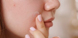 Pimple Patches: Δοκίμασα 10 αυτοκόλλητα για σπυράκια και ξεχώρισα τα 3 κορυφαία